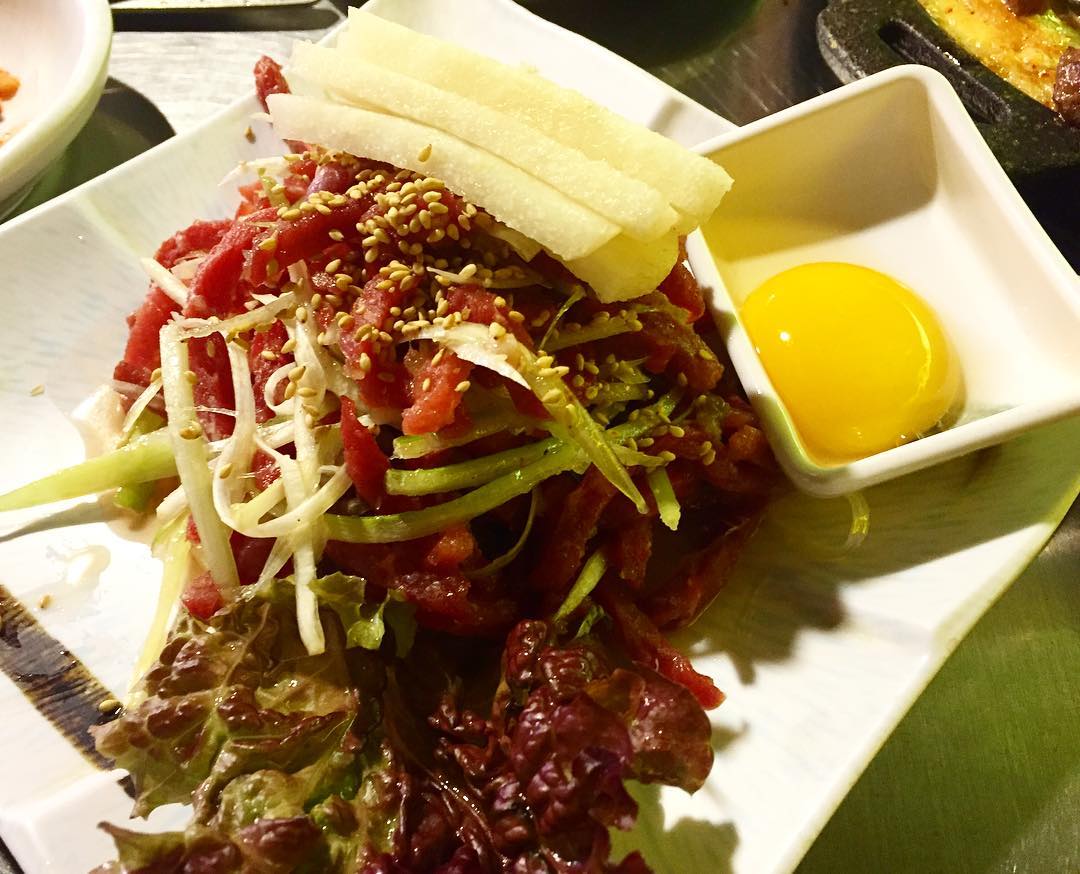 서브1