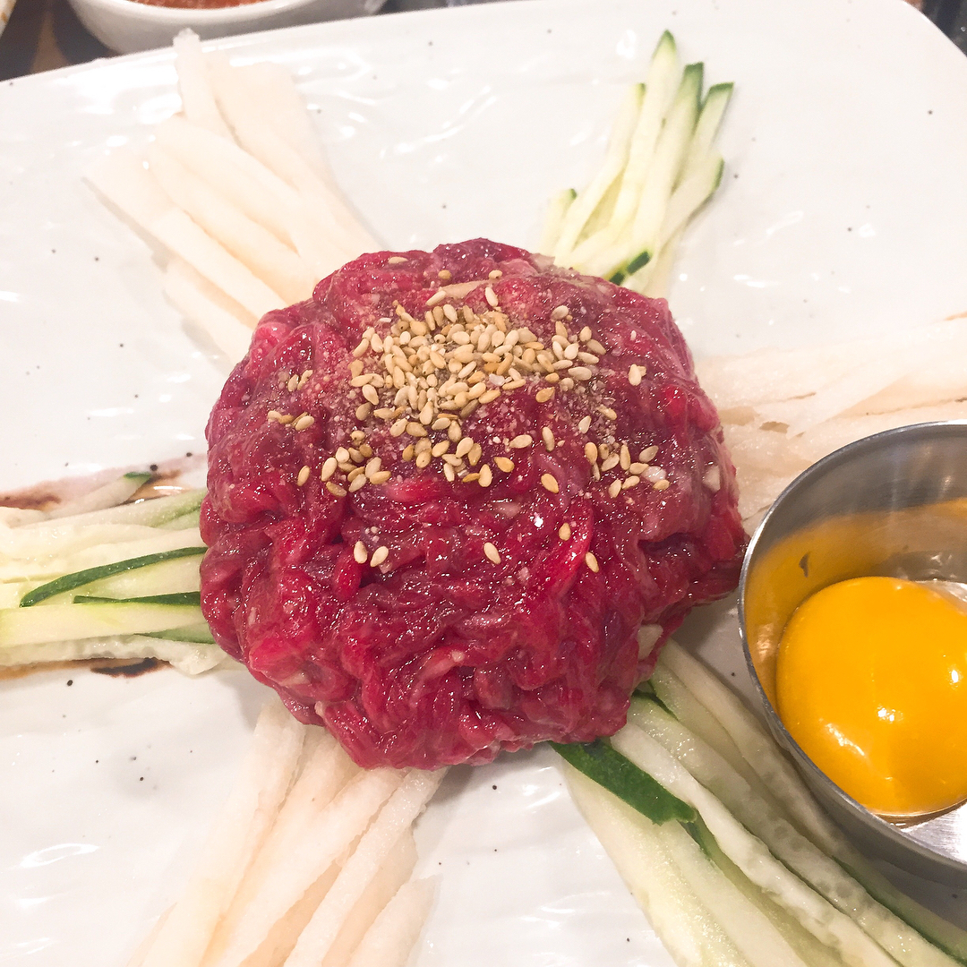 서브1