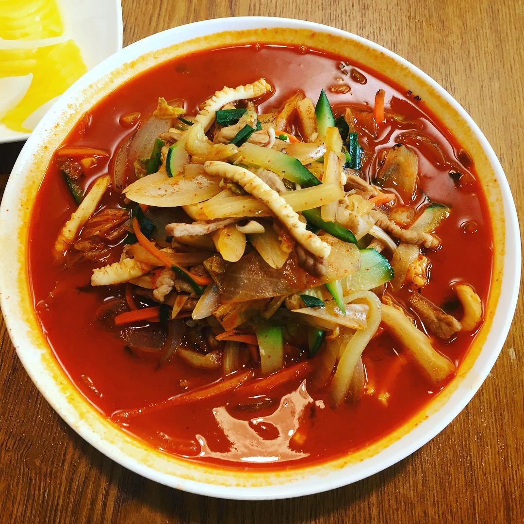 서브1